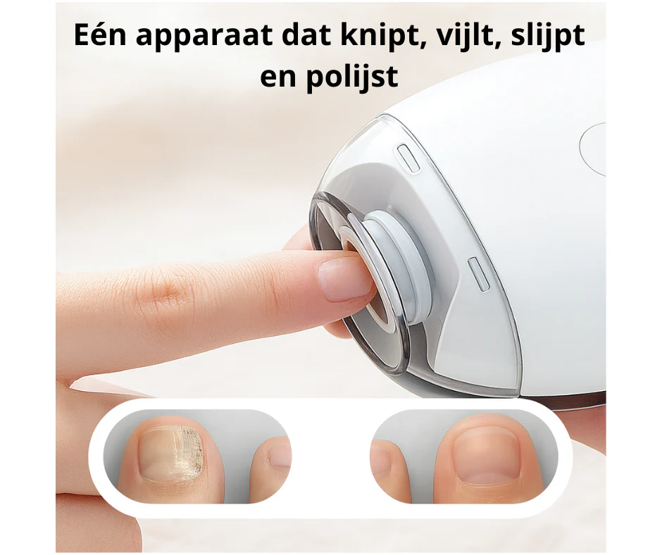 NAILGUARD™ | VEILIG EN PIJNVRIJ KNIPPEN